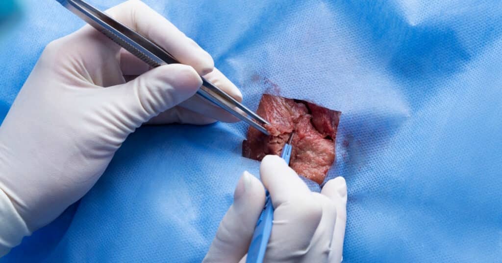 phobie des opérations chirurgicales nom